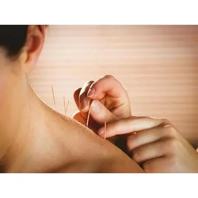Acupuncture And Chinese Medicine Treatment 中医治疗 (Subang Jaya) 1